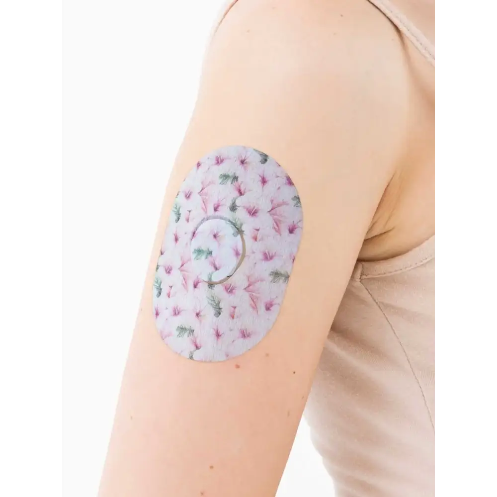 Patch adhésif Dexcom G7, série Spring, sur le bras, gros plan
