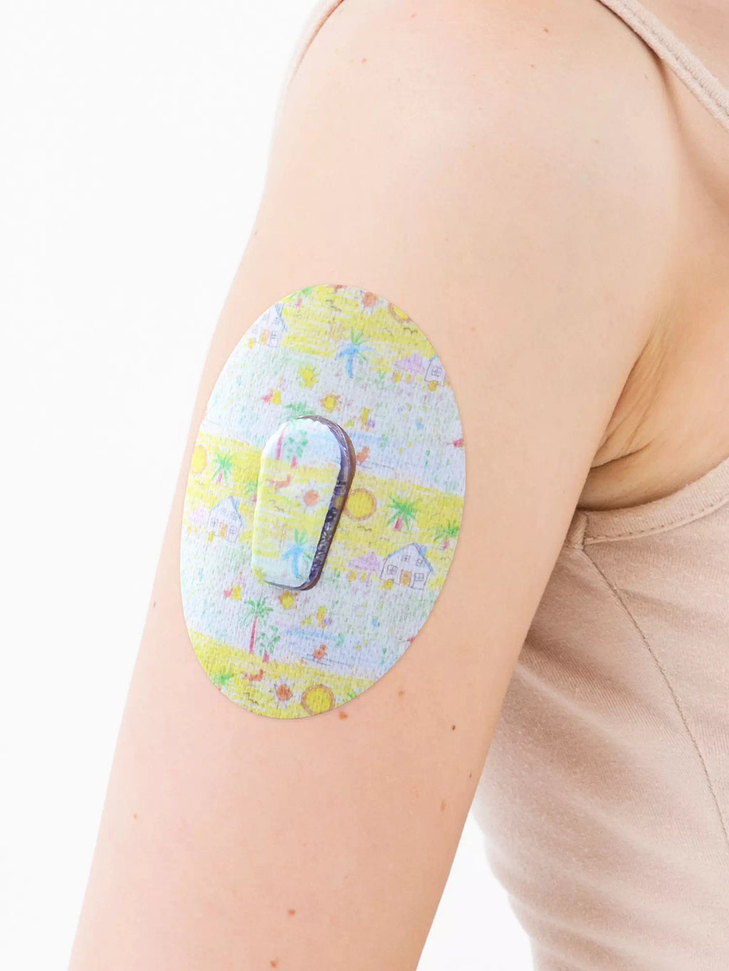 Patch adhésif Dexcom G6, motif Childhood Memories, sur le bras