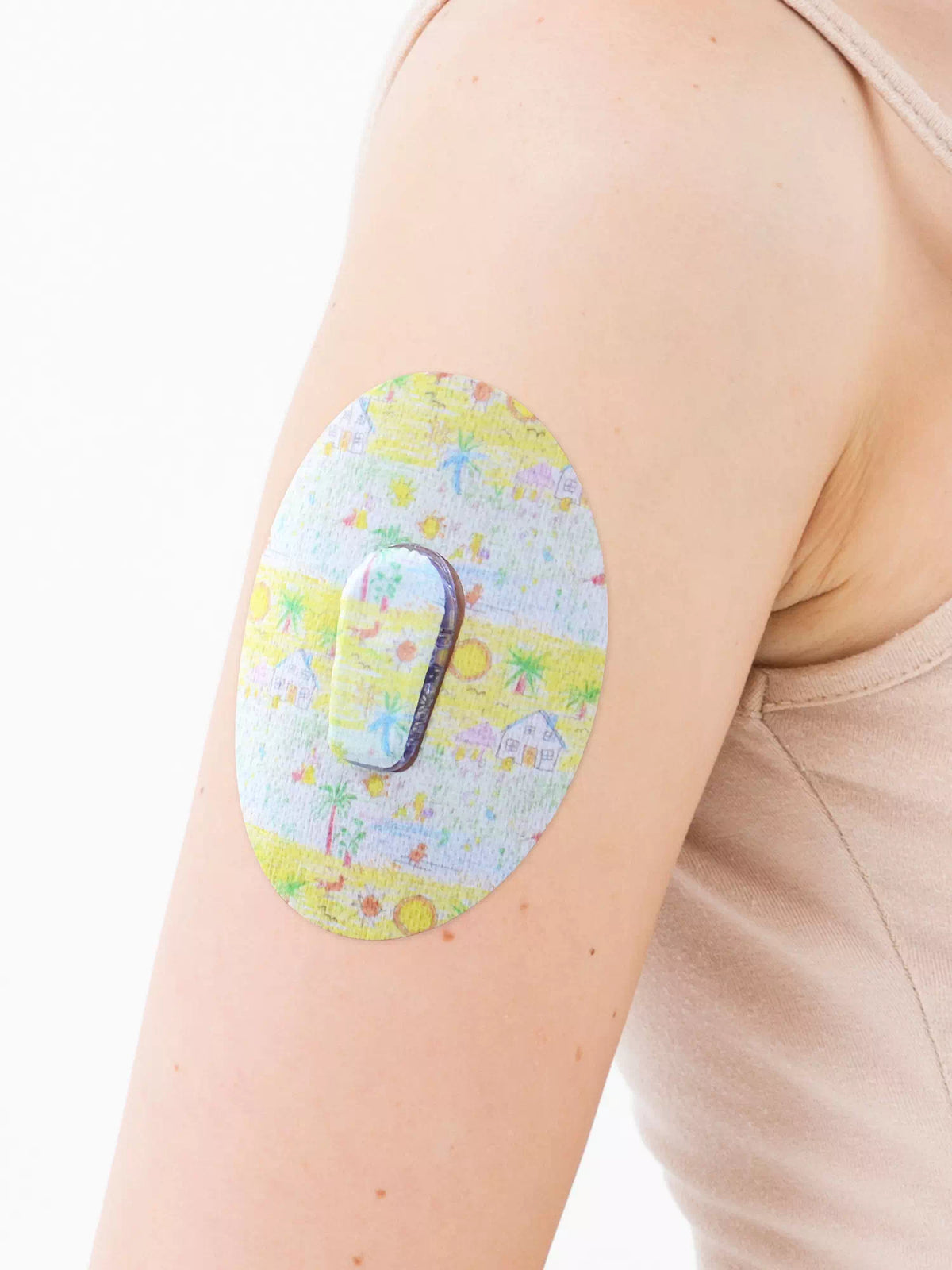 Patch adhésif Dexcom G6, motif Childhood Memories, sur le bras