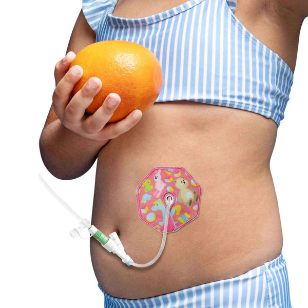 Coussinets de gastrostomie enfants – Motifs mignons & confort au quotidien | Kaio-Tube Pads